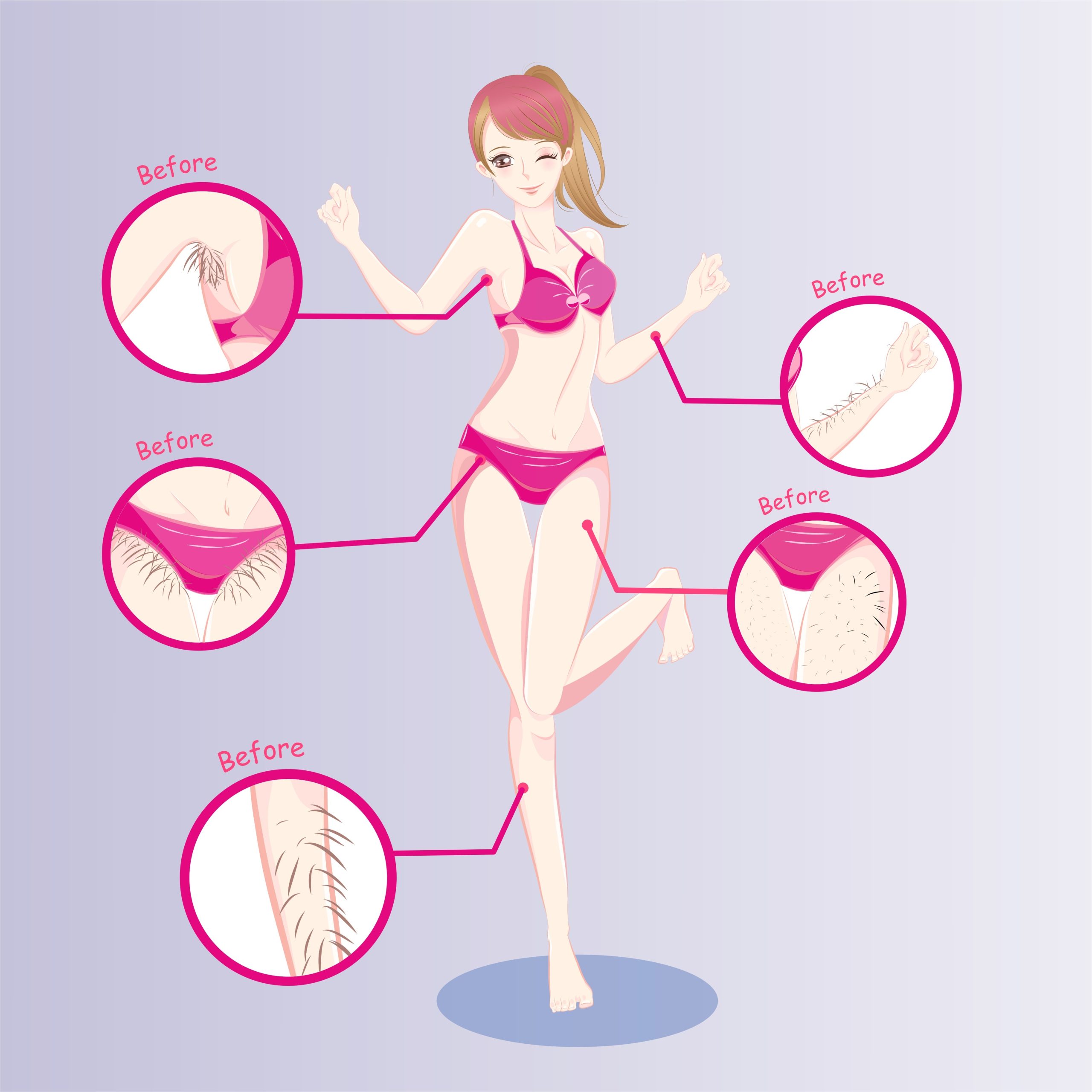 Dessin de 5 zones que les femmes font traditionnellement épiler