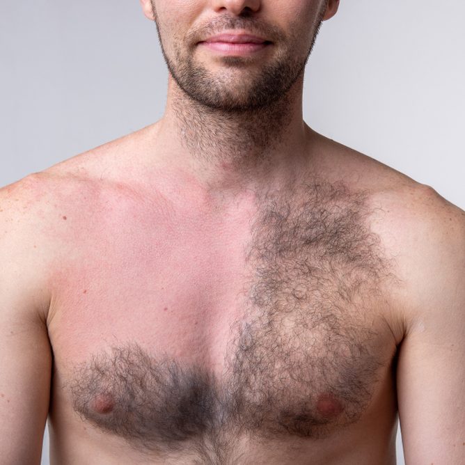 Les hommes n'aiment plus avoir un torse poilu. L'épilation